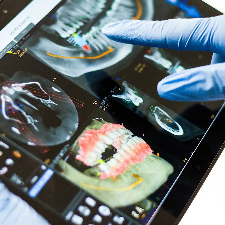 Röntgenaufnahme von Zähnen.